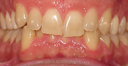 Before & Afters
