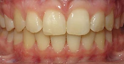 Before & Afters