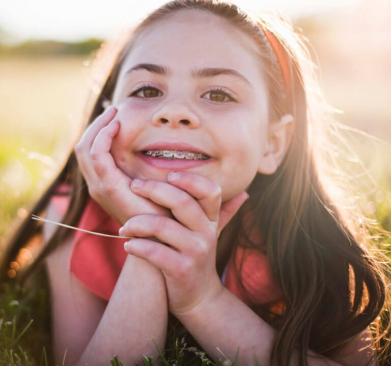 Traditional metal braces