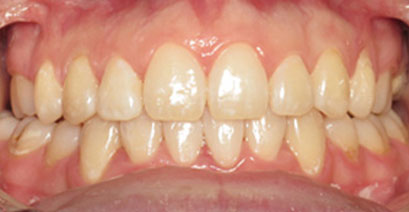 Before & Afters