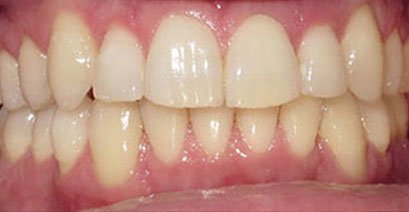 Before & Afters