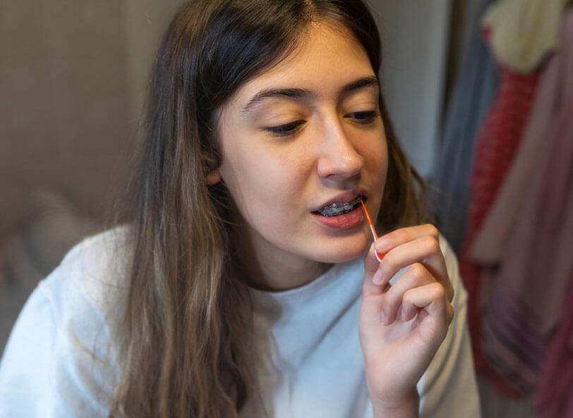 Cleaning your teeth with braces Cleaning your teeth with braces