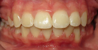 Before & Afters
