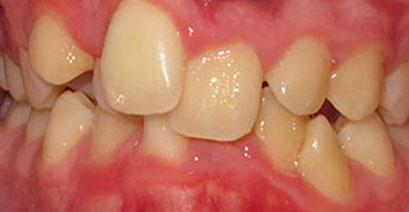 Before & Afters