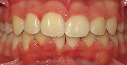 Before & Afters