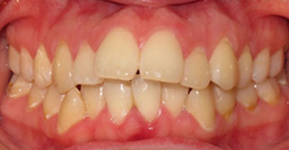 Before & Afters