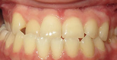 Before & Afters