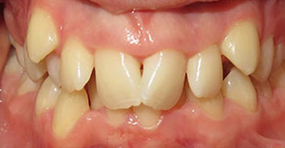 Before & Afters