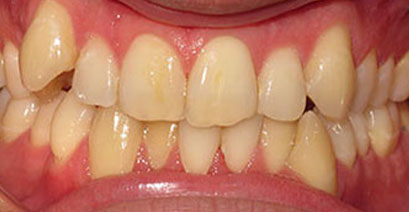 Before & Afters
