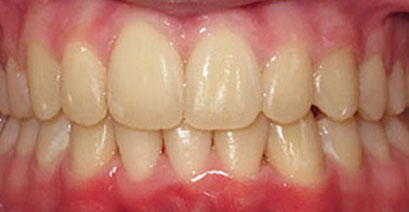 Before & Afters