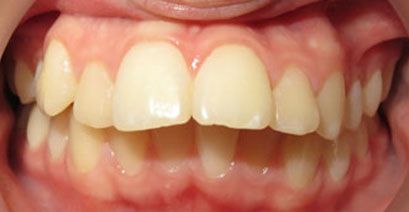 Before & Afters