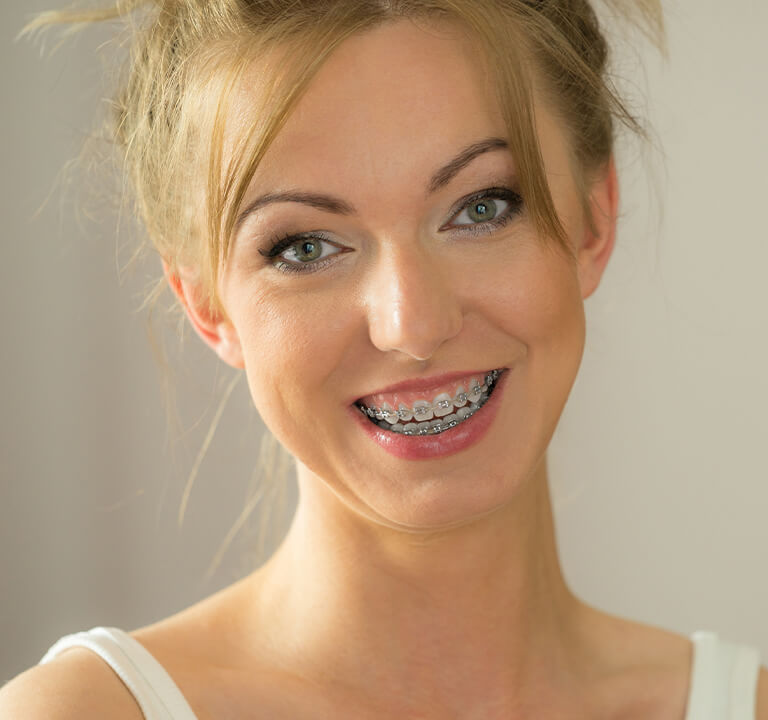 Tooth mousse