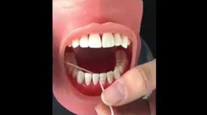 How to clean your bonded retainer