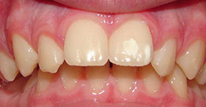 Before & Afters