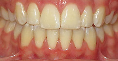Before & Afters