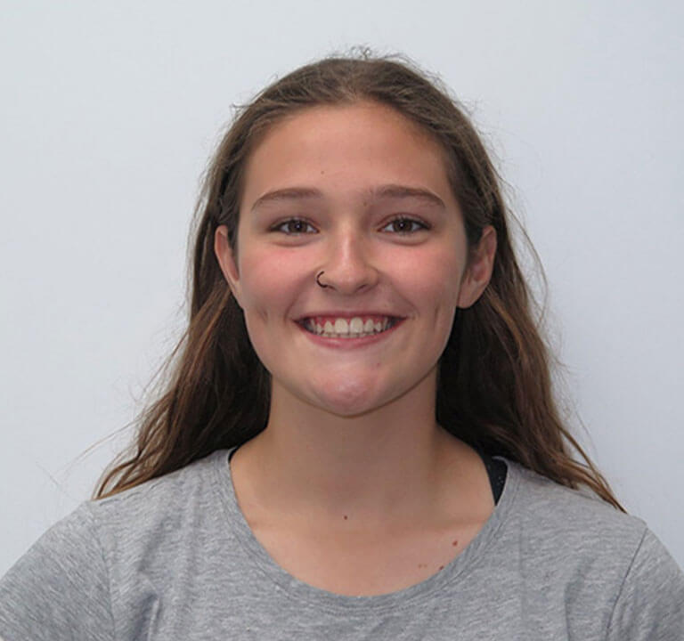 Experience the Torque Orthodontics difference