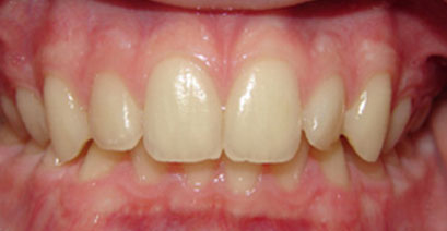 Before & Afters