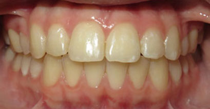 Before & Afters