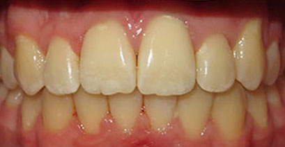 Before & Afters