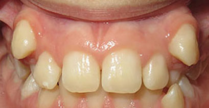 Before & Afters