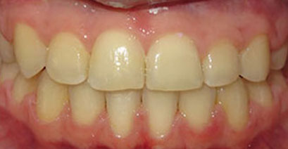 Before & Afters
