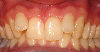 Before & Afters