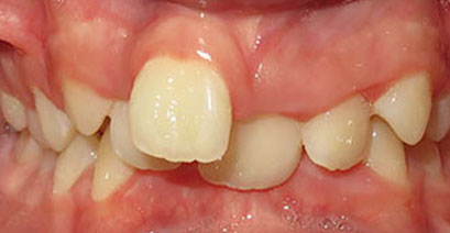 Before & Afters