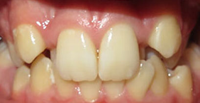 Before & Afters
