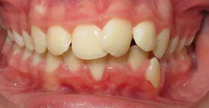Before & Afters