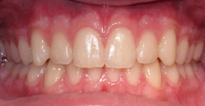 Before & Afters