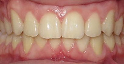 Before & Afters