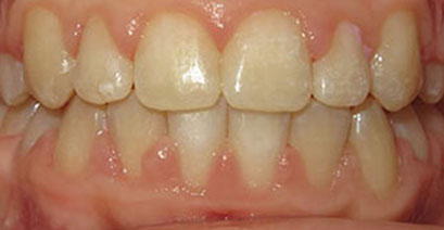 Before & Afters