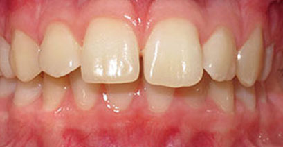 Before & Afters
