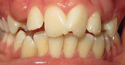 Before & Afters