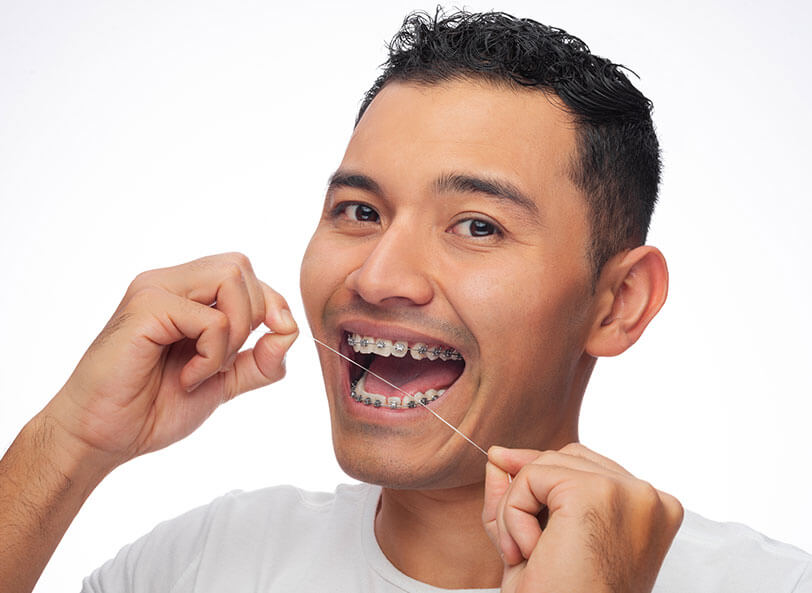 How to care for your braces
