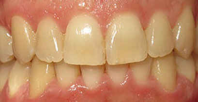 Before & Afters