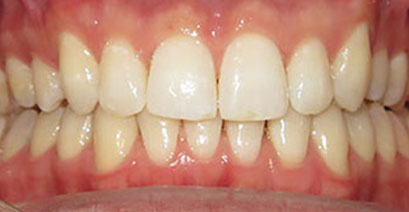 Before & Afters