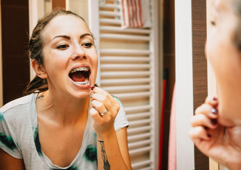 How to fix your braces How to fix your braces