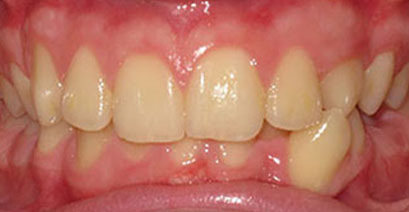 Before & Afters