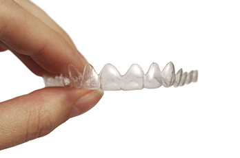 Invisalign faqs