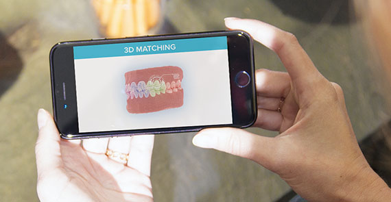 Dental Monitoring